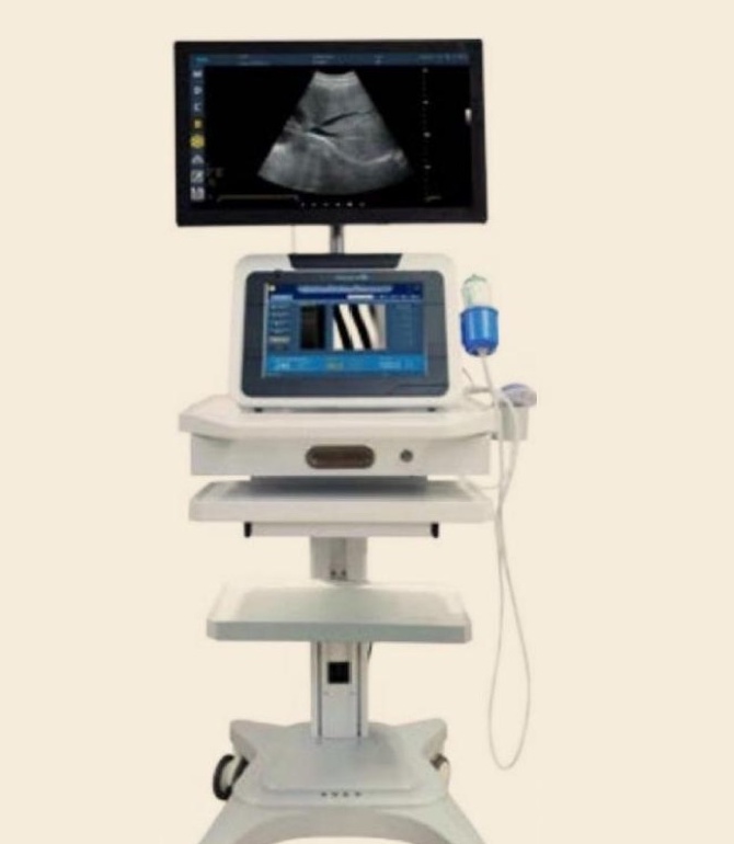 FibroScan Liver Shear-Wave Elastography